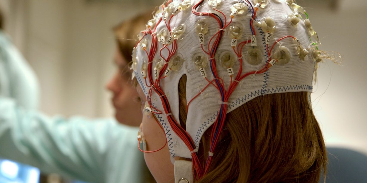 Epilepsie: Was gibt es Neues aus Forschung und Praxis?
